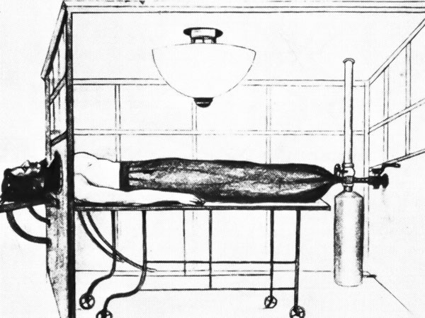 La chambre à pression négative inventée par Ferdinand Sauerbruch en 1904