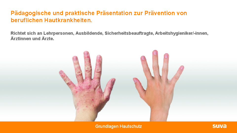 Hautallergien vermeiden