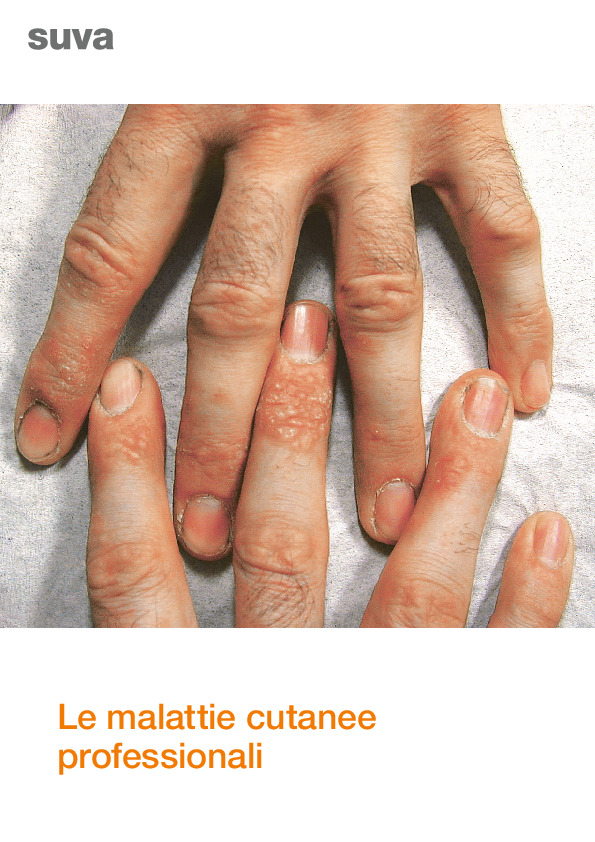 Le dermatosi professionali