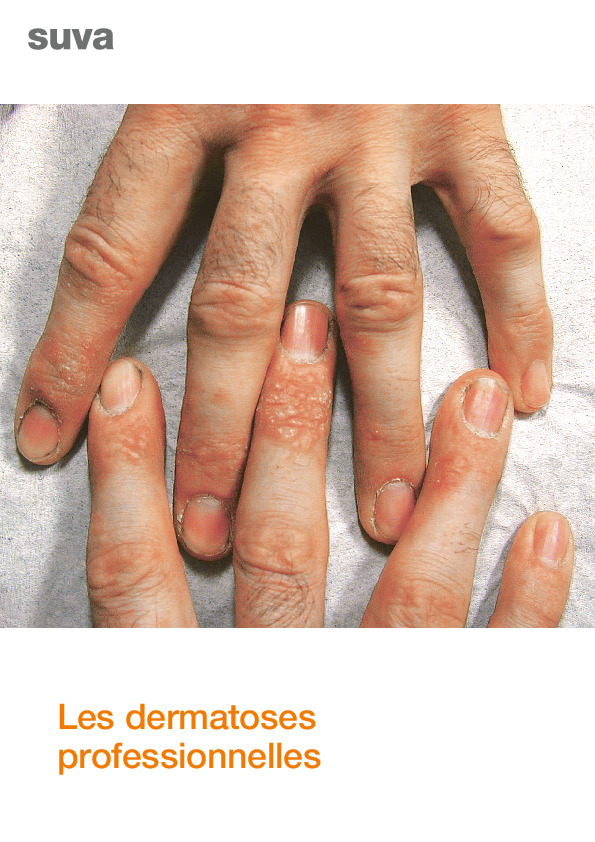 Les dermatoses professionnelles
