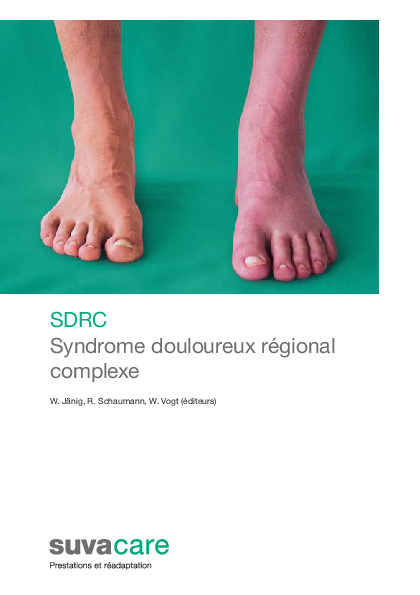 Publication SDRC Syndrome douloureux régional complexe