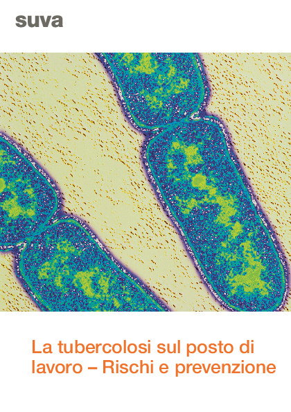 Evitare il contagio da tubercolosi sul posto di lavoro