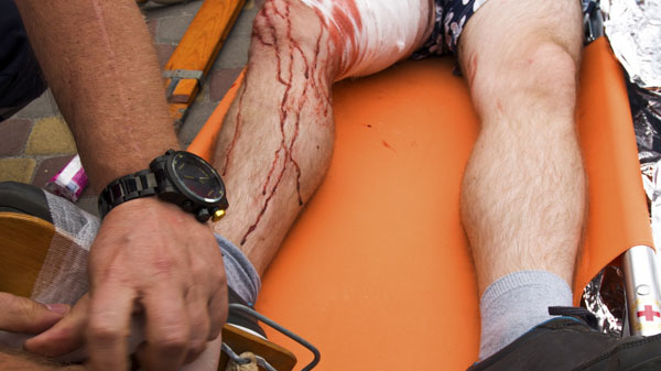 Mann mit Beinverletzung, Symbolbild