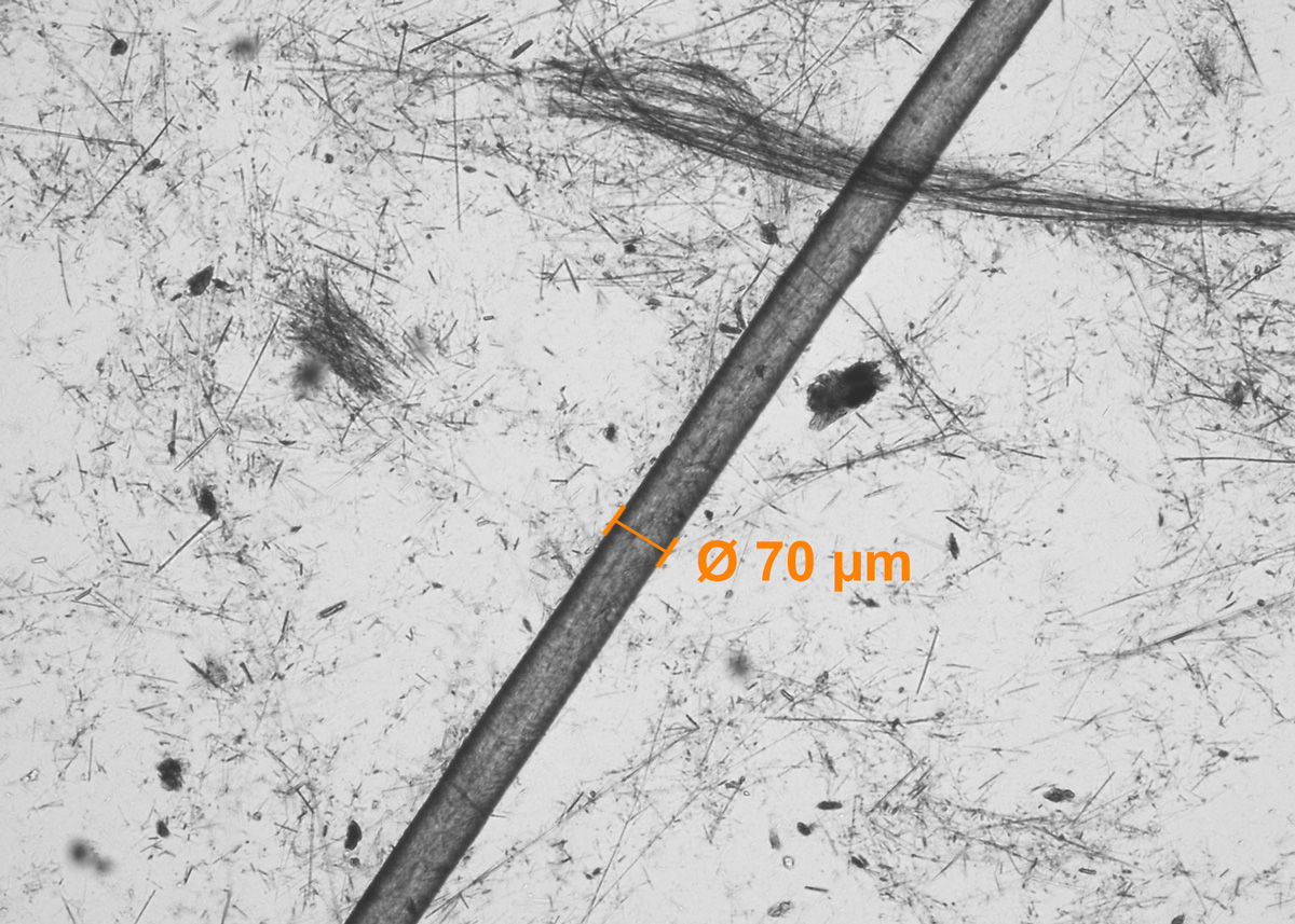 Viele Asbestfasern sind rund 100 Mal dünner als ein menschliches Haar und damit nicht mal im Lichtmikroskop sichtbar.